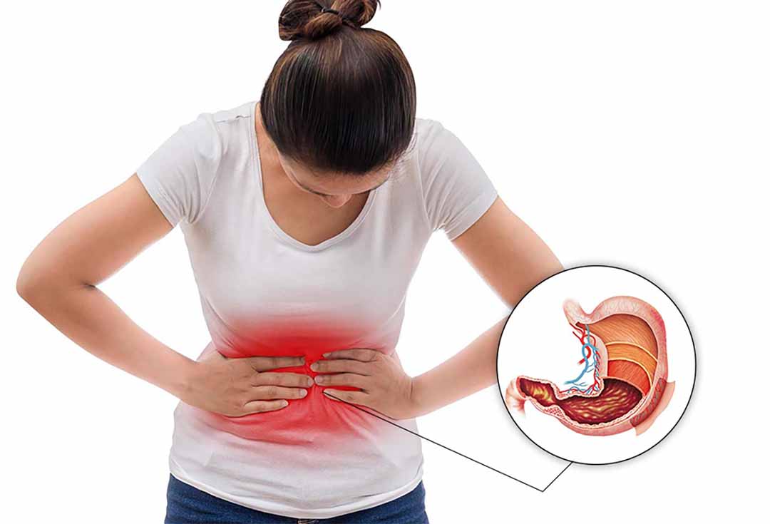 Người bệnh đau âm ỉ vùng trên rốn do viêm loét dạ dày