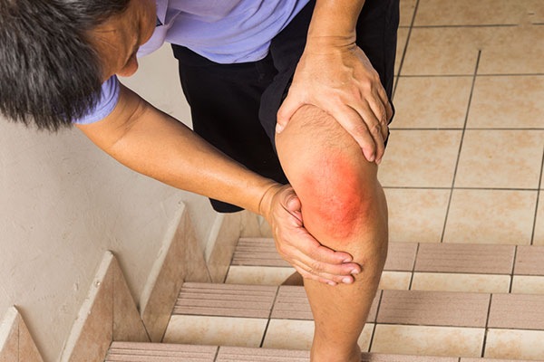 xương khớp ở người lớn tuổi thường đau gối khi leo cầu thang